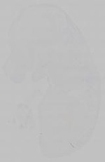 EMAGE:15373