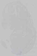 EMAGE:15375