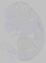 EMAGE:15391