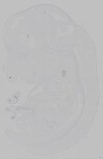 EMAGE:15393