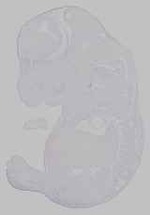 EMAGE:15415