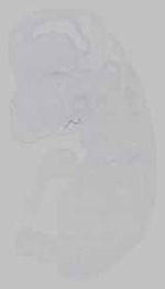 EMAGE:15416