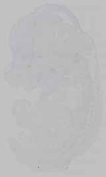 EMAGE:15422