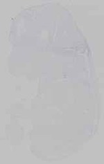 EMAGE:15426