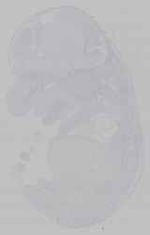 EMAGE:15431