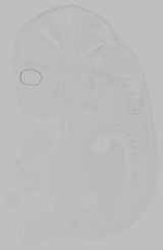 EMAGE:15432