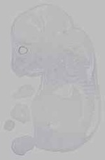 EMAGE:15432
