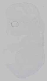 EMAGE:15446