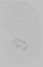 EMAGE:15453
