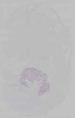 EMAGE:15453