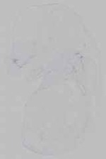 EMAGE:15457