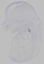 EMAGE:15457