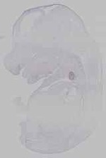 EMAGE:15457