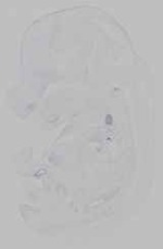 EMAGE:15457