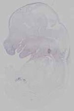 EMAGE:15457