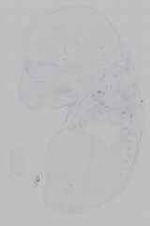 EMAGE:15457