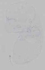 EMAGE:15457