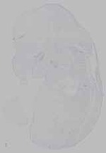 EMAGE:15466