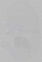 EMAGE:15467
