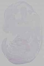 EMAGE:15467