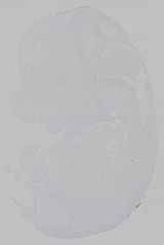 EMAGE:15468