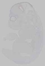 EMAGE:15469