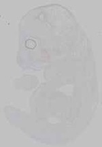 EMAGE:15469