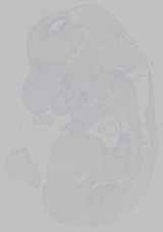 EMAGE:15469