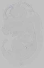 EMAGE:15469