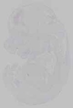 EMAGE:15469