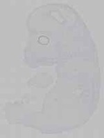 EMAGE:15469