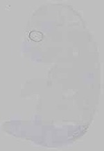 EMAGE:15479