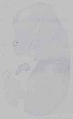 EMAGE:15482
