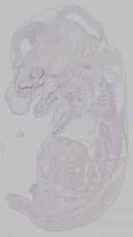 EMAGE:15485