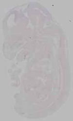 EMAGE:15511