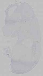 EMAGE:15519
