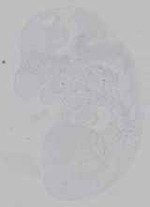EMAGE:15524