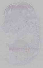 EMAGE:15524