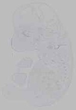 EMAGE:15524