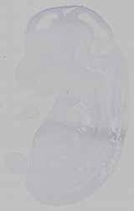 EMAGE:15528