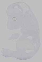 EMAGE:15532