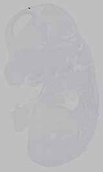 EMAGE:15532