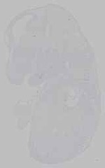 EMAGE:15532