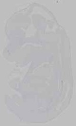 EMAGE:15532