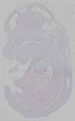 EMAGE:15532