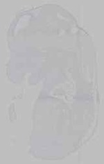 EMAGE:15532
