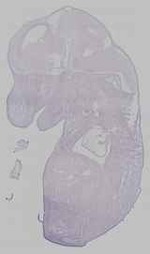 EMAGE:15532