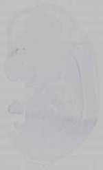 EMAGE:15556