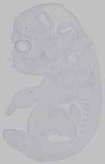 EMAGE:15557