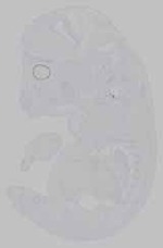 EMAGE:15557